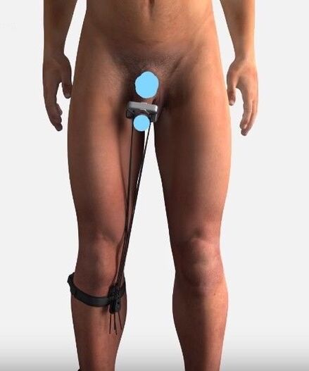 A device to increase a member