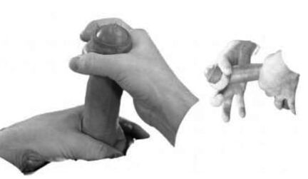Sprain of penis to increase it