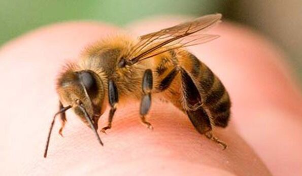 Bee sting - an extreme way to enlarge phallus